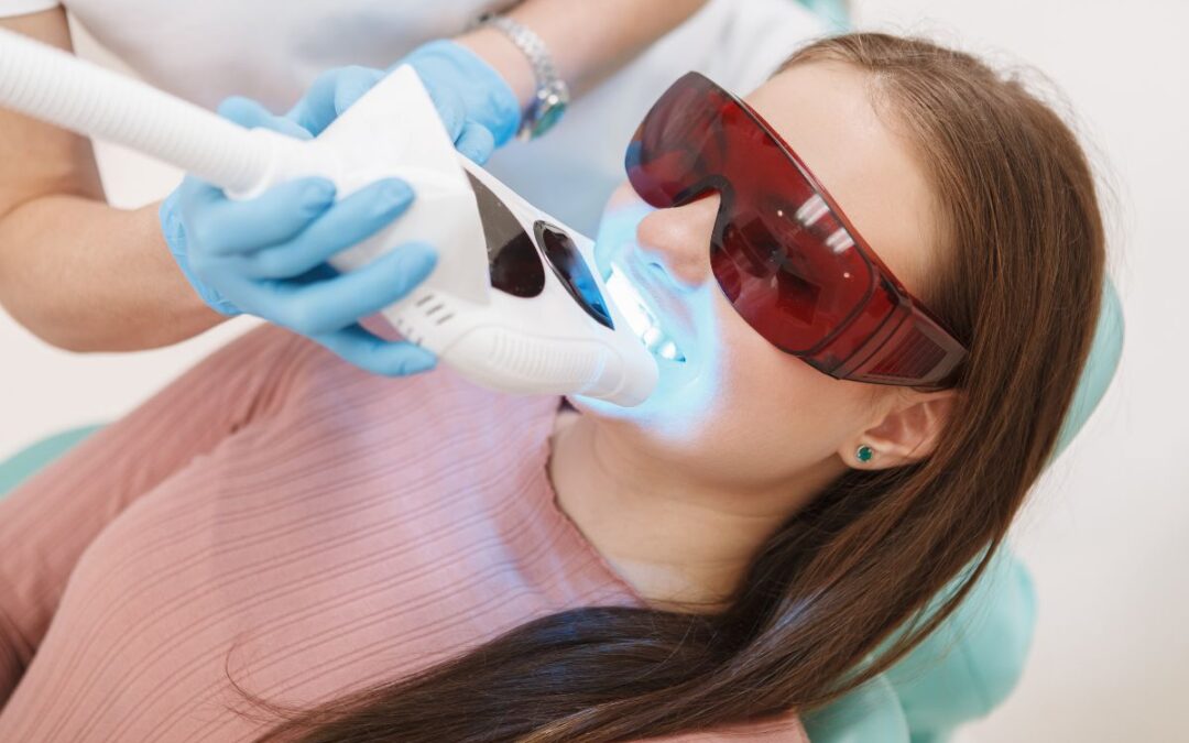Sbiancamento Dentale LED, ottieni un sorriso brillante